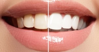 Teeth Whitening Courses